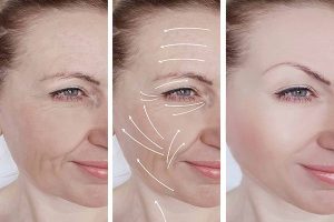 عمليات التجميل الشائعة