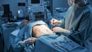 عمليات التجميل