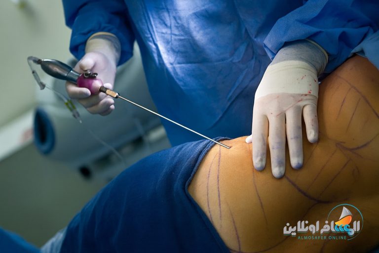 عمليات حقن الدهون